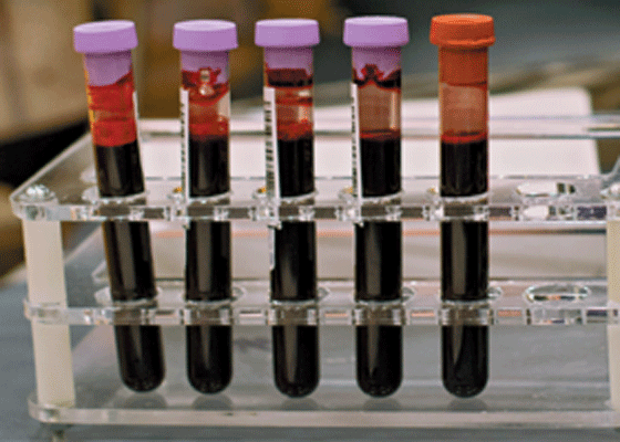 Image for article Jiangxi Woman Has 17 Vials of Blood Drawn While Serving One Year for Her Faith, Organ Matching Suspected